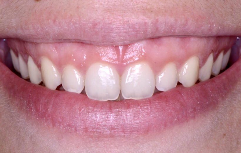 Before Image