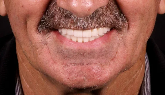 Before Image